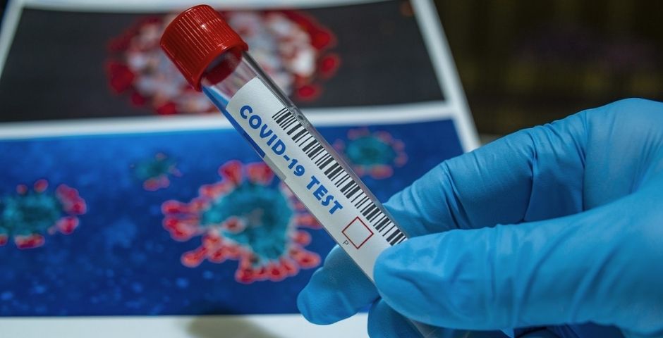 Уже 214 человек скончались от коронавируса в Мурманской области