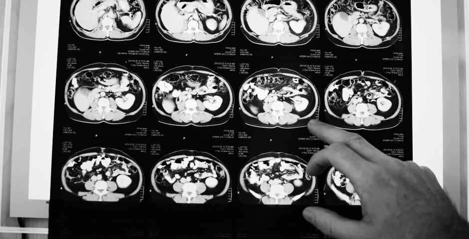 Ученые назвали два продукта, которые улучшают здоровье мозга