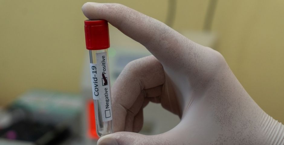 В России выявили минимум новых случаев коронавируса с сентября прошлого года
