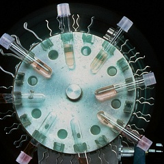 Выявляемость онкологии: растет и количество, и качество